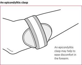 Splints for Tennis Elbow